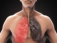 پاکسازی ریه